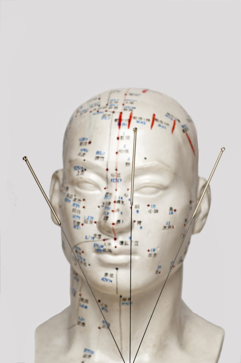 Learn about acupuncture with Plant City Natural Medicine & Pain Center
