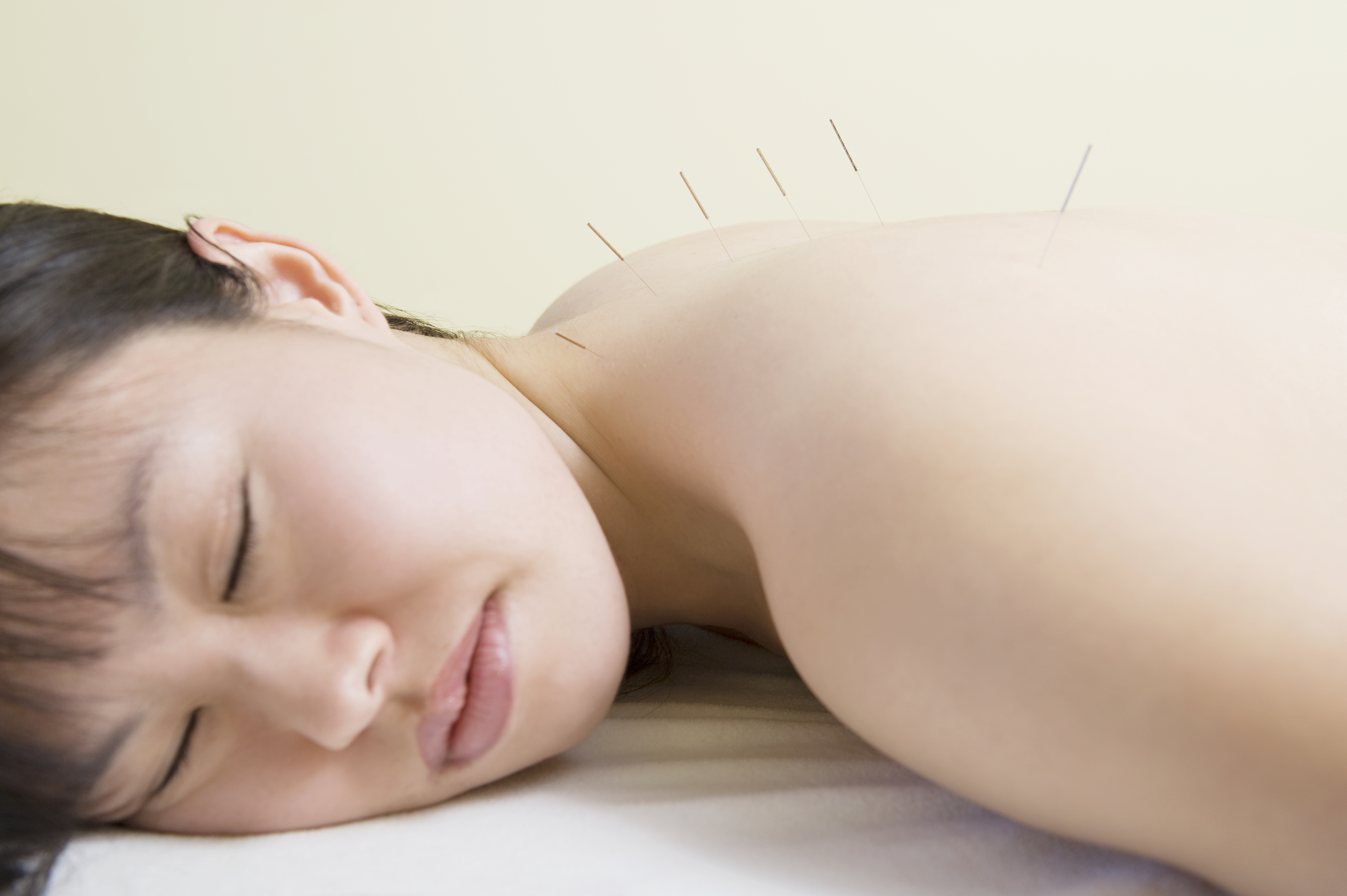 Learn about acupuncture with Plant City Natural Medicine & Pain Center part 5. Natural